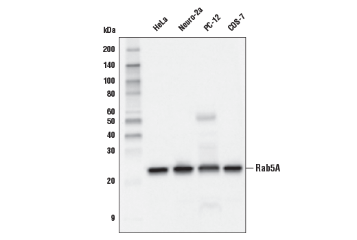 undefined Image 12: Vesicle Trafficking Antibody Sampler Kit