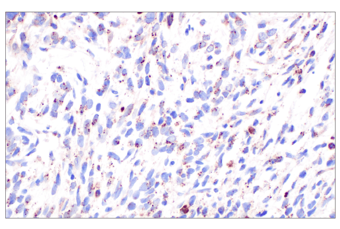 Immunohistochemistry Image 2: Cathepsin A (F8X9E) Rabbit Monoclonal Antibody