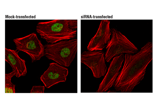Immunofluorescence Image 1: LRF/Pokemon (D7U2O) Rabbit Monoclonal Antibody