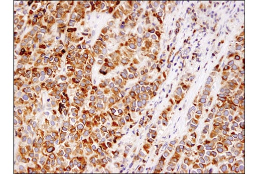 Immunohistochemistry Image 1: Bcl-2 (124) Mouse Monoclonal Antibody
