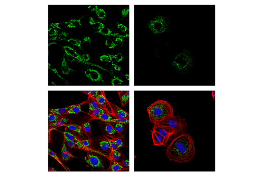 Immunofluorescence Image 1: Glutaminase-1/GLS1 (E4T9Q) Rabbit Monoclonal Antibody
