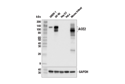 Western Blotting Image 2: ACE2 (E1E1I) Mouse Monoclonal Antibody