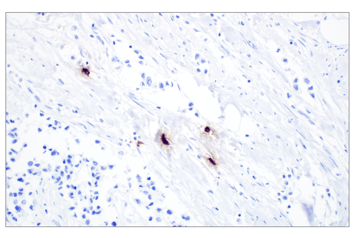 Immunohistochemistry Image 4: Mast Cell Chymase/CMA1 (F6S4Q) Rabbit Monoclonal Antibody