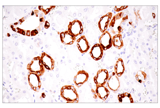 Immunohistochemistry Image 2: Keratin 7 (RN7) Mouse Monoclonal Antibody