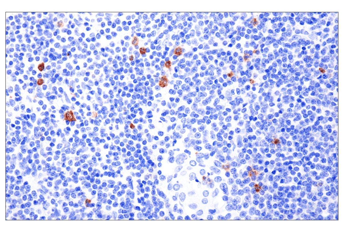 Immunohistochemistry Image 5: CD177 (F9O5U) Rabbit Monoclonal Antibody