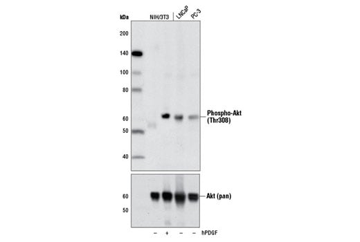 undefined Image 1: PhosphoPlus<sup>®</sup> Akt (Thr308) Antibody Duet