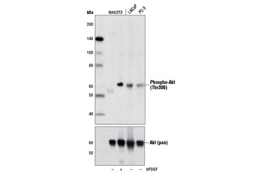 undefined Image 1: Insulin/IGF-1 Signaling Pathway Antibody Sampler Kit