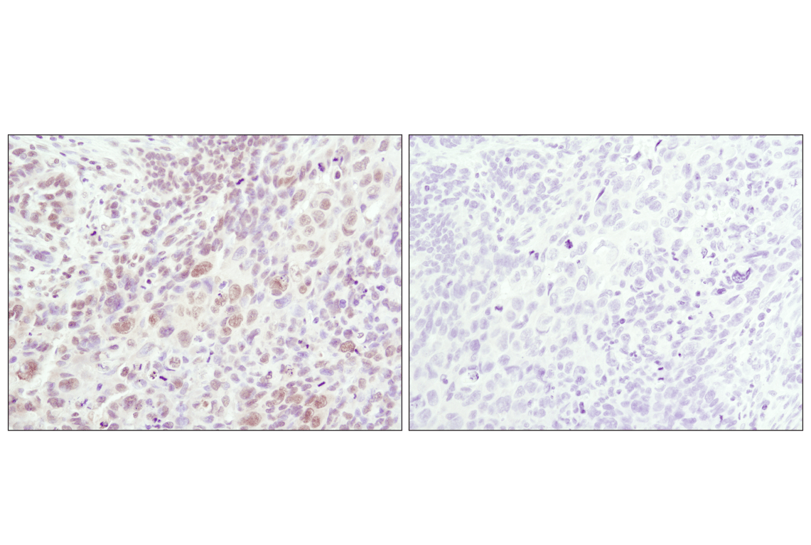 Immunohistochemistry Image 2: Phospho-SAPK/JNK (Thr183/Tyr185) (81E11) Rabbit Monoclonal Antibody (BSA and Azide Free)
