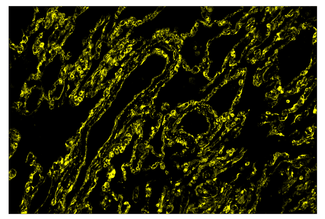 Immunohistochemistry Image 2: Phospho-S6 Ribosomal Protein (Ser235/236) (D57.2.2E) & CO-0107-750 SignalStar<sup>™</sup> Oligo-Antibody Pair