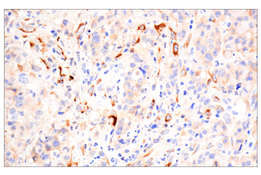 Immunohistochemistry Image 1: TIMP1 (D10E6) Rabbit Monoclonal Antibody
