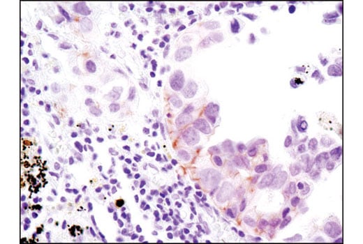 Immunohistochemistry Image 3: Phospho-HER3/ErbB3 (Tyr1289) (D1B5) Rabbit Monoclonal Antibody (BSA and Azide Free)