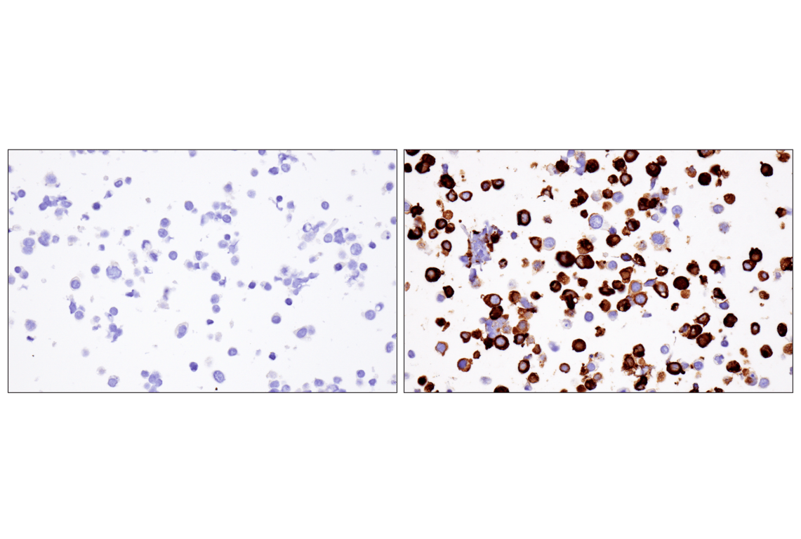 Nipah/Hendra virus Nucleocapsid (F5N9K) Rabbit Monoclonal Antibody