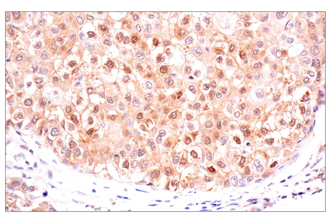 Immunohistochemistry Image 4: ACBP/DBI (E4V8V) Rabbit Monoclonal Antibody