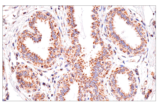 Immunohistochemistry Image 1: SDHB (E3H9Z) Rabbit Monoclonal Antibody