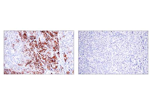 Immunohistochemistry Image 9: NCAM1 (CD56) (E7X9M) Rabbit Monoclonal Antibody (BSA and Azide Free)