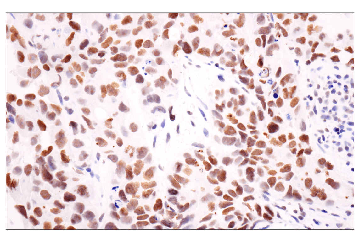 Immunohistochemistry Image 1: Acetyl-Histone H4 (Lys16) (E2B8W) Rabbit Monoclonal Antibody