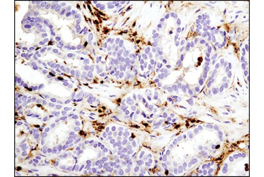 Immunohistochemistry Image 2: S100A4 (D9F9D) Rabbit Monoclonal Antibody (BSA and Azide Free)