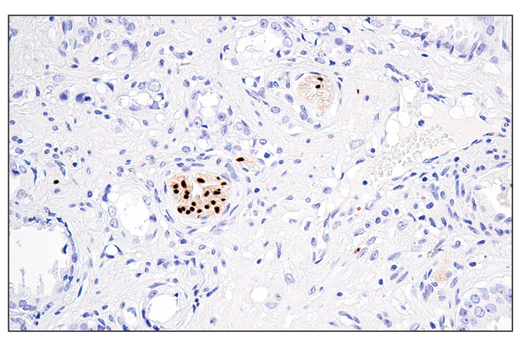 Immunohistochemistry Image 1: Sox10 (E6B6I) Rabbit Monoclonal Antibody (BSA and Azide Free)