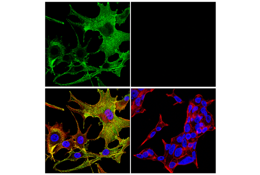 Immunofluorescence Image 1: MCAM (E3F3E) Rabbit Monoclonal Antibody (BSA and Azide Free)