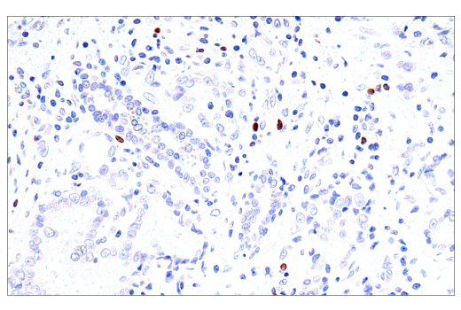 Immunohistochemistry Image 4: GNLY (E2T3D) Rabbit Monoclonal Antibody