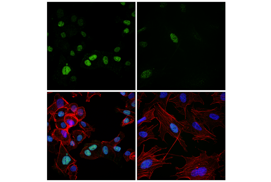 Immunofluorescence Image 2: Rad51 (F1G6C) Rabbit Monoclonal Antibody