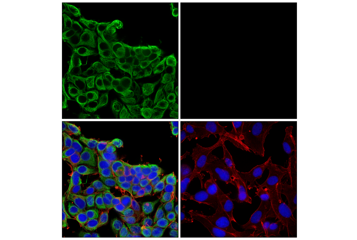 Immunofluorescence Image 1: Keratin 8/18 (C51) Mouse Monoclonal Antibody (Alexa Fluor<sup>®</sup> 488 Conjugate)
