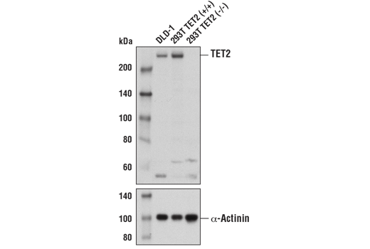 Western Blotting Image 1: TET2 (D6B9Y) Rabbit mAb