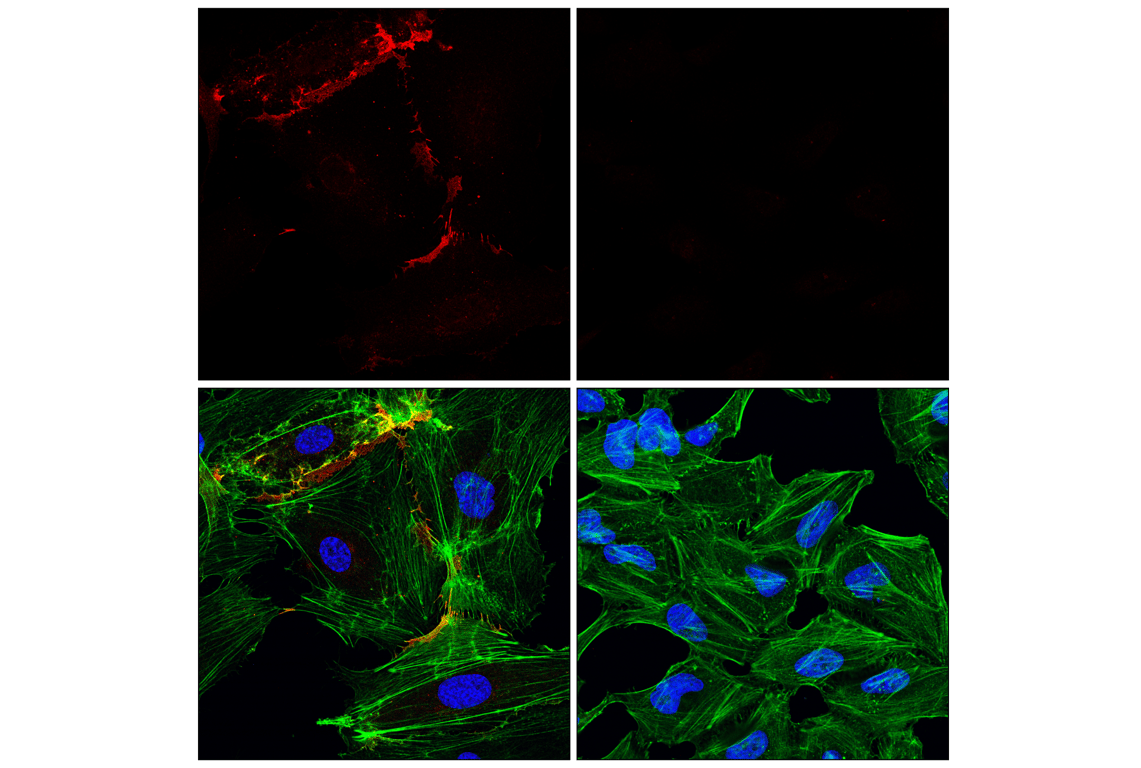 CD31 (PECAM-1) (89C2) Mouse mAb (Alexa Fluor® 647 Conjugate