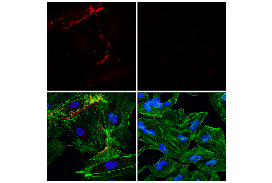 Immunofluorescence Image 1: CD31 (PECAM-1) (89C2) Mouse mAb (Alexa Fluor<sup>®</sup> 647 Conjugate)