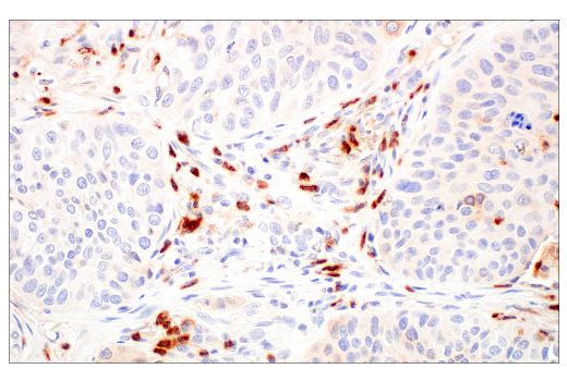 Immunohistochemistry Image 5: LCN2 (D4M8L) Rabbit Monoclonal Antibody