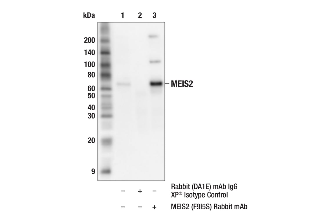 Immunoprecipitation Image 1: MEIS2 (F9I5S) Rabbit Monoclonal Antibody