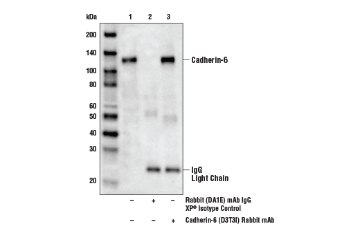 Immunoprecipitation Image 1: Cadherin-6 (D3T3I) Rabbit Monoclonal Antibody