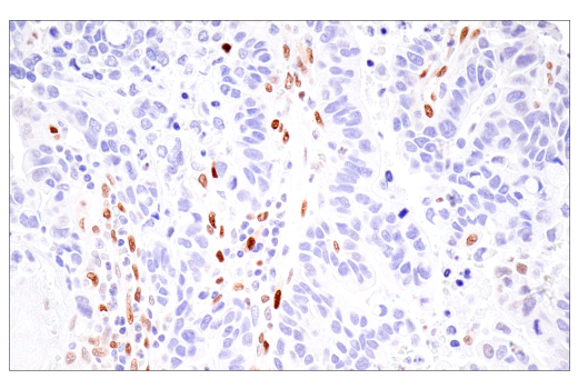 Immunohistochemistry Image 1: HIF-1 alpha (E1V6A) Rabbit Monoclonal Antibody (BSA and Azide Free)