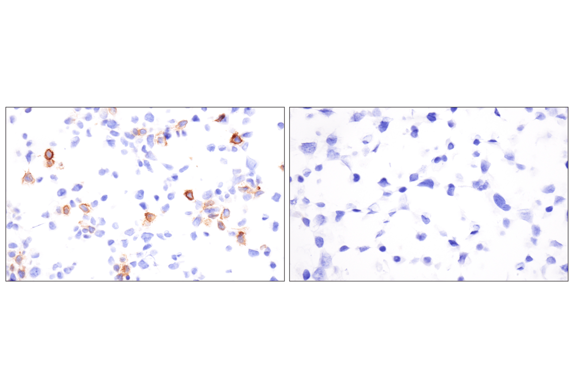 Immunohistochemistry Image 12: LRRC15 (E4X8J) Rabbit Monoclonal Antibody