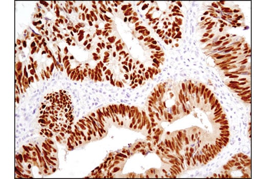 Immunohistochemistry Image 2: CDX2 (D11D10) Rabbit Monoclonal Antibody (BSA and Azide Free)