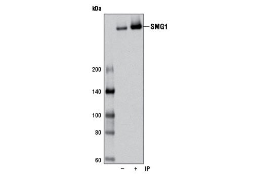 Immunoprecipitation Image 1: SMG-1 (D42D5) Rabbit Monoclonal Antibody