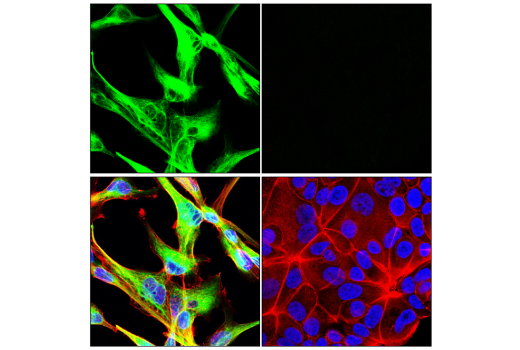 Immunofluorescence Image 1: Nestin (E4O9E) Rabbit Monoclonal Antibody (BSA and Azide Free)