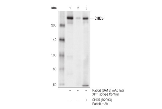Immunoprecipitation Image 1: CHD5 (D2F9Q) Rabbit Monoclonal Antibody