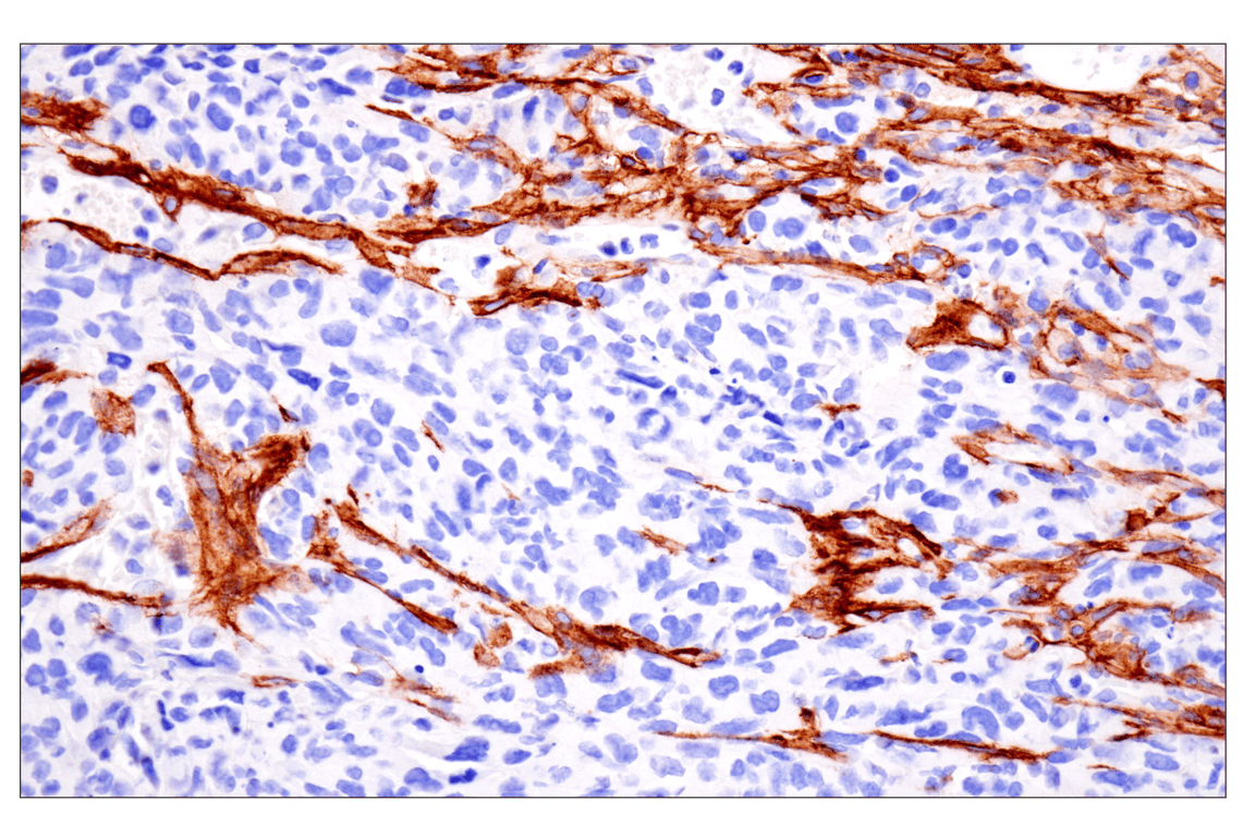 Immunohistochemistry Image 8: LRRC15 (E4X8J) Rabbit Monoclonal Antibody