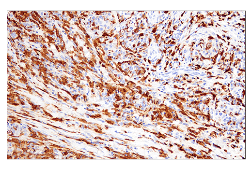 Immunohistochemistry Image 4: Iba1/AIF-1 (E5N4J) Mouse Monoclonal Antibody (BSA and Azide Free)