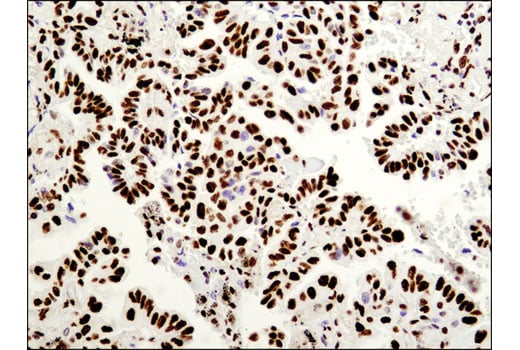 Immunohistochemistry Image 2: AUF1/hnRNP D (D6O4F) Rabbit Monoclonal Antibody