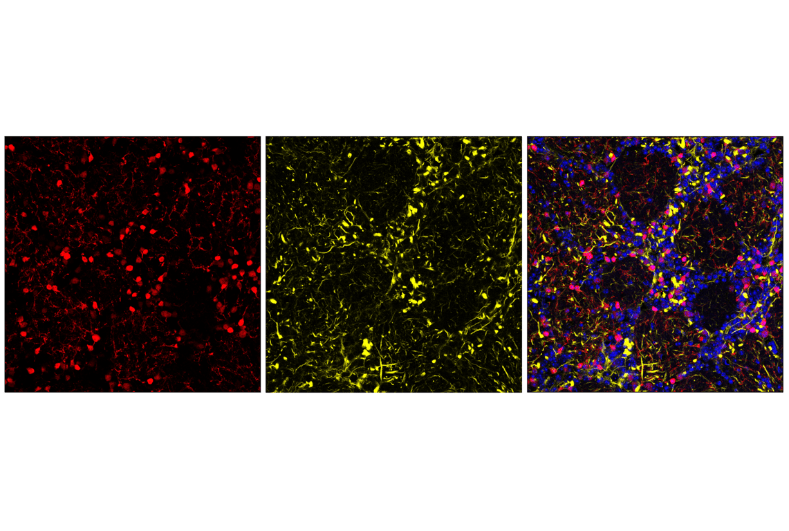 Immunofluorescence Image 1: Anti-rabbit IgG (H+L), F(ab')<sub>2</sub> Fragment (Alexa Fluor<sup>®</sup> 555 Conjugate)