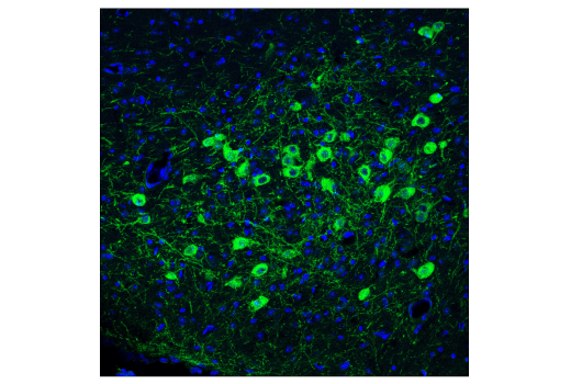 Immunofluorescence Image 1: p75NTR (D4B3) Rabbit Monoclonal Antibody