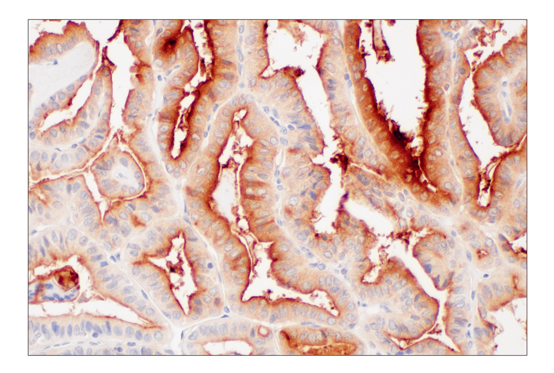 Immunohistochemistry Image 2: LY6E (F8Y1R) Rabbit Monoclonal Antibody