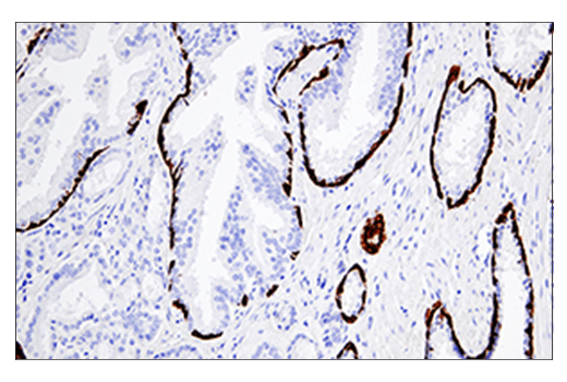 Immunohistochemistry Image 1: Keratin 5 (E2T4B) Rabbit Monoclonal Antibody
