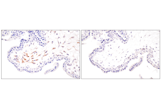 Immunohistochemistry Image 10: CTHRC1 (E8M9S) Rabbit Monoclonal Antibody