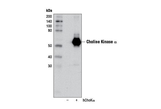 Western Blotting Image 2: Choline Kinase alpha (D5X9W) Rabbit Monoclonal Antibody