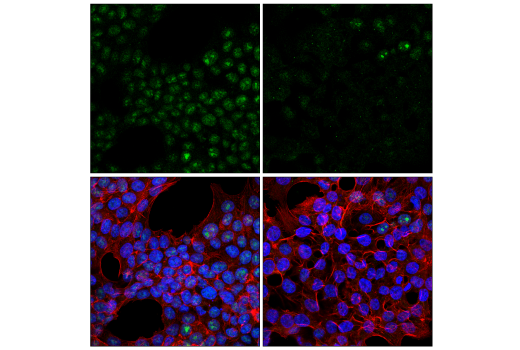 Immunofluorescence Image 1: METTL16 (E2J1D) Rabbit Monoclonal Antibody