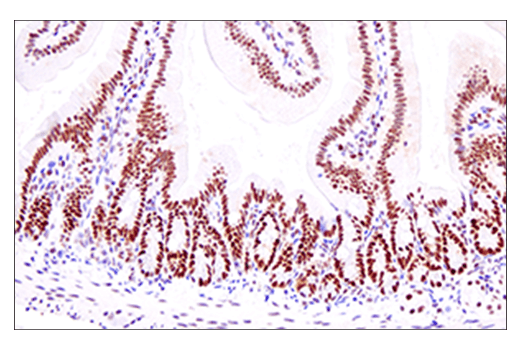 Immunohistochemistry Image 6: EED (E4L6E) Rabbit Monoclonal Antibody