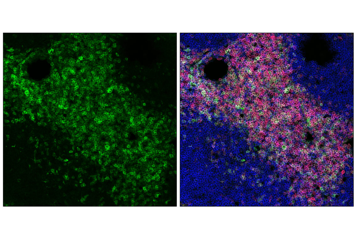 Immunofluorescence Image 1: CD5 (E5O4W) Rabbit mAb